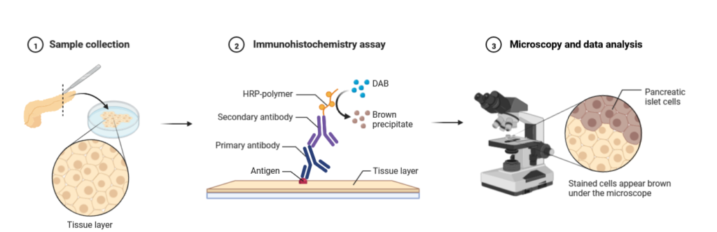 Xét nghiệm Hóa mô miễn dịch (Immunohistochemistry)