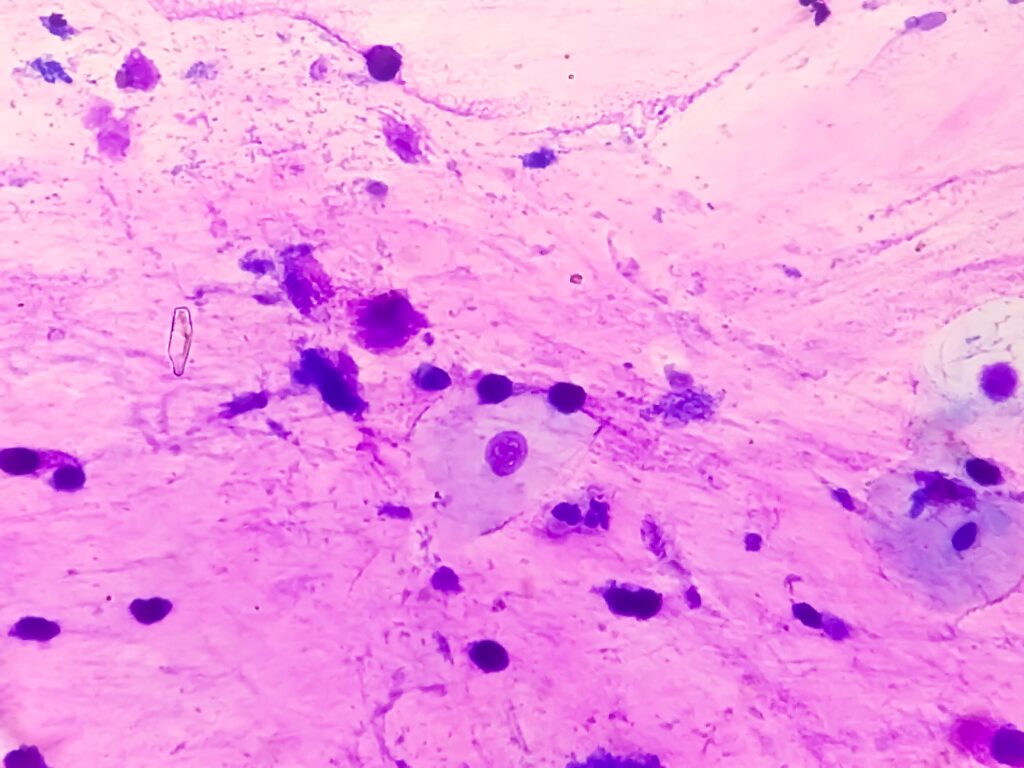 Xét nghiệm tế bào học (Cytopathology)