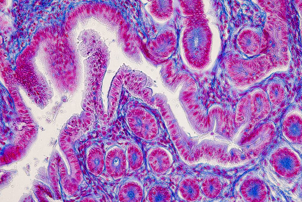 Xét nghiệm mô bệnh học (Histopathology)