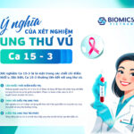 ung-thu-vu