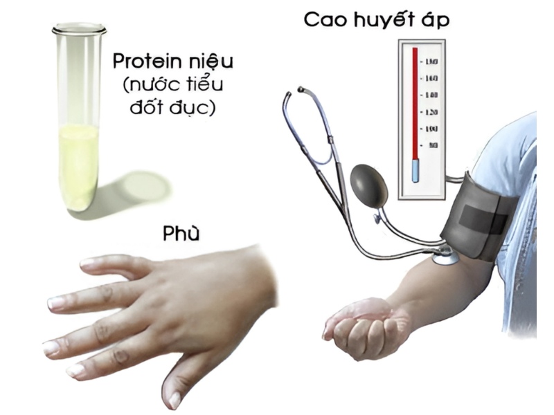 dau-hieu-tien-san-giat-1