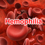 benh_hemophilia