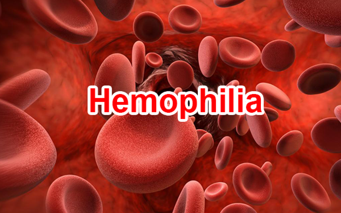 Bệnh máu khó đông (Hemophilia) và các xét nghiệm chẩn đoán