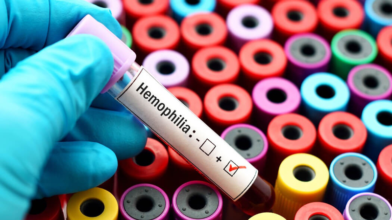 benh_hemophilia