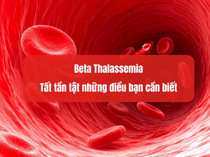 Beta Thalassemia: Tất tần tật những điều bạn cần biết