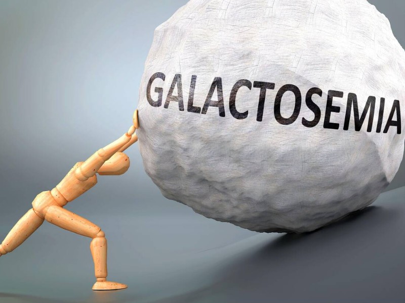 Galactosemia là gì? Tìm hiểu bệnh rối loạn chuyển hoá Galactose