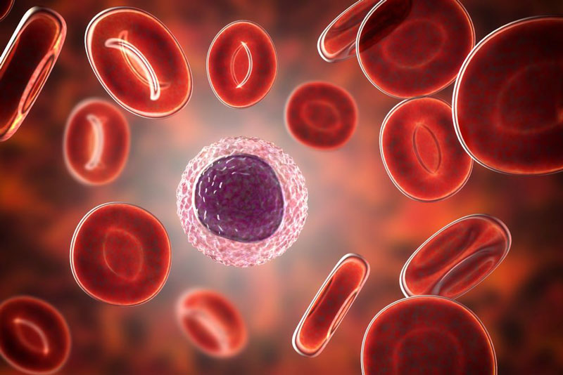 Bệnh Lơ xê mi (Leukemia): Nguyên nhân, triệu chứng và phương pháp điều trị