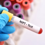nitp-nguy-co-cao