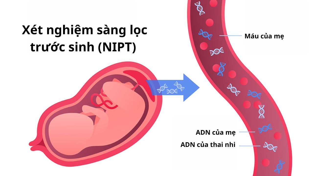 xet-nghiem-nipt