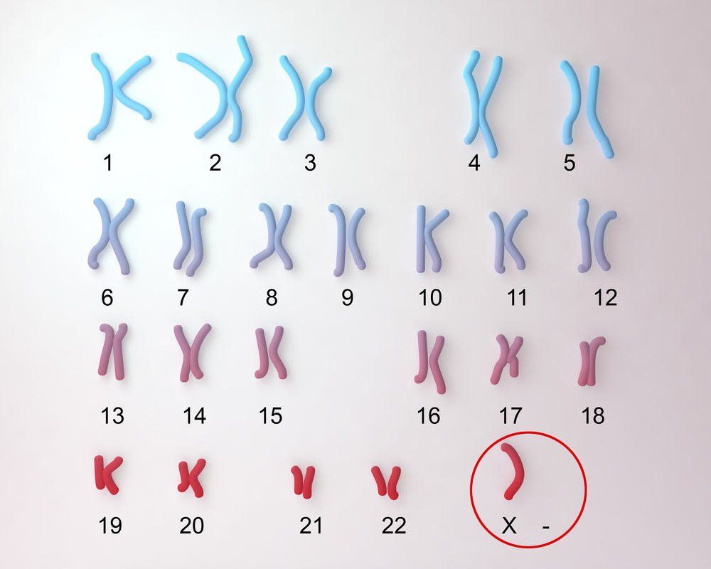 xet-nghiem-nipt